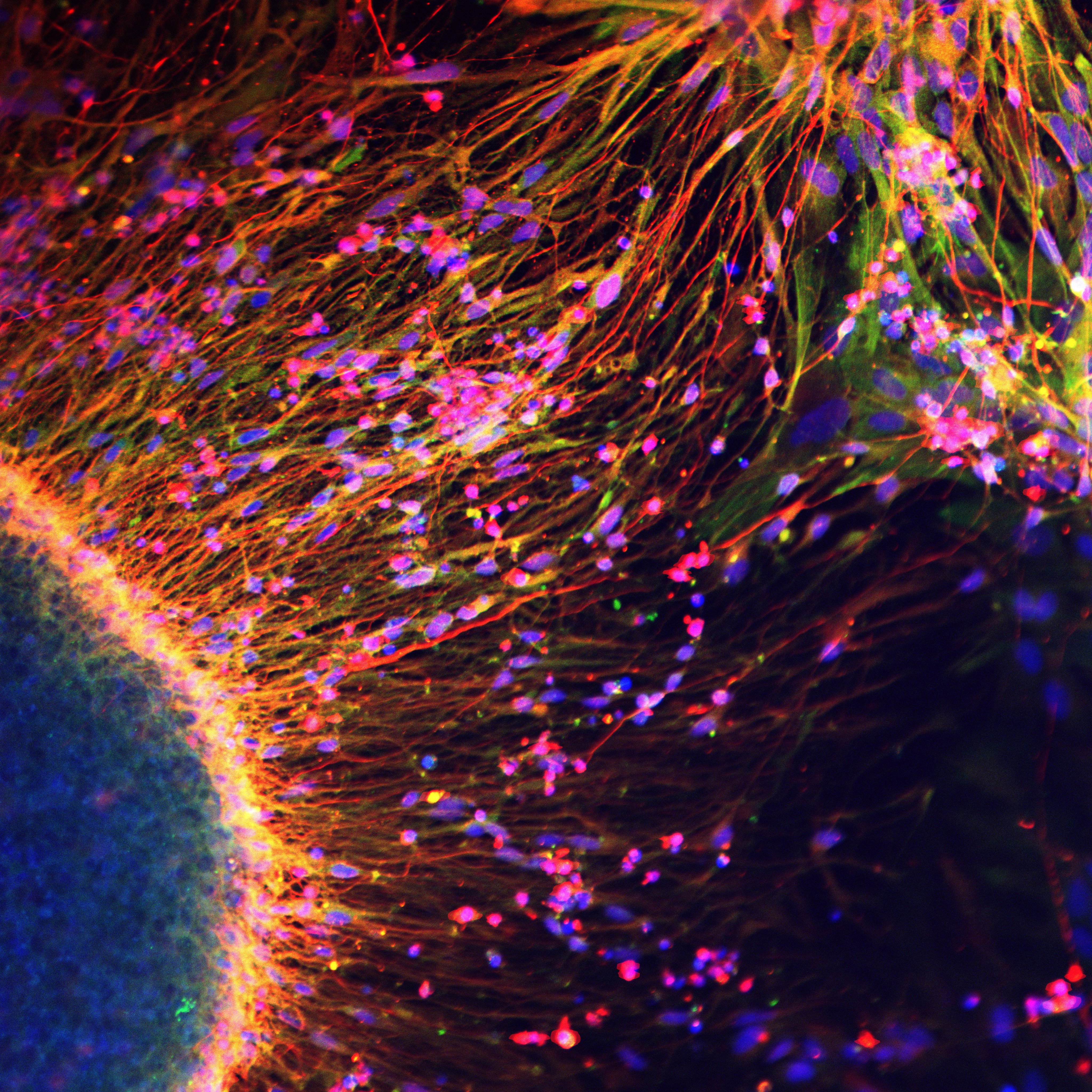 1_Pamies_David_Reaching the sun.jpg